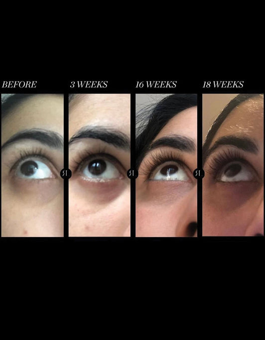 سيروم تطويل الرموش Revitalash® Advanced Eyelash Conditioner 